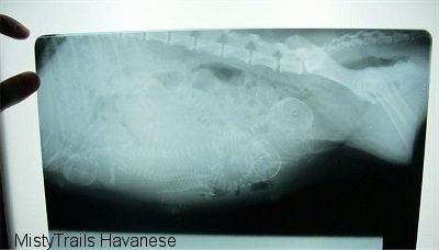 Röntgen av en gravid dam som är emot ett ljus.